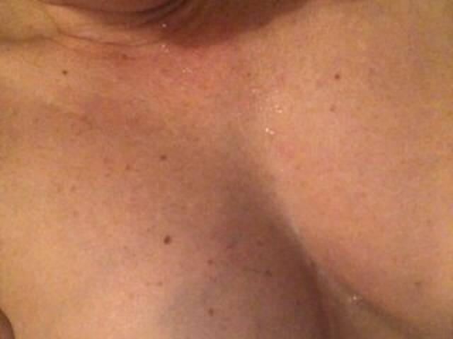 Sugárzási képernyőképek Alianakiss