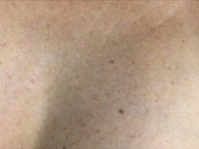 Sugárzási képernyőképek Alianakiss