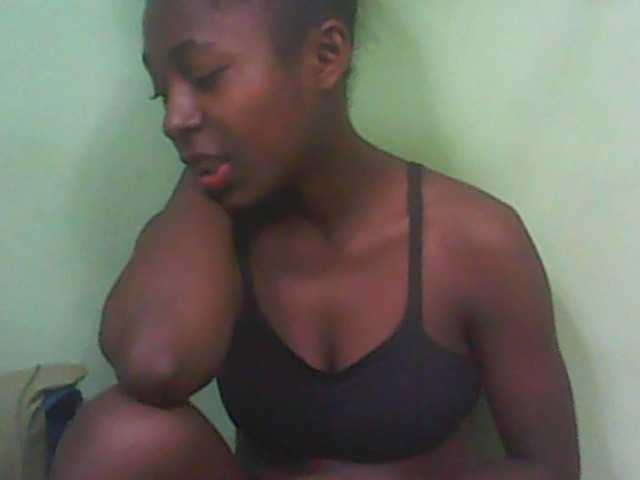 Sugárzási képernyőképek Aurelia42