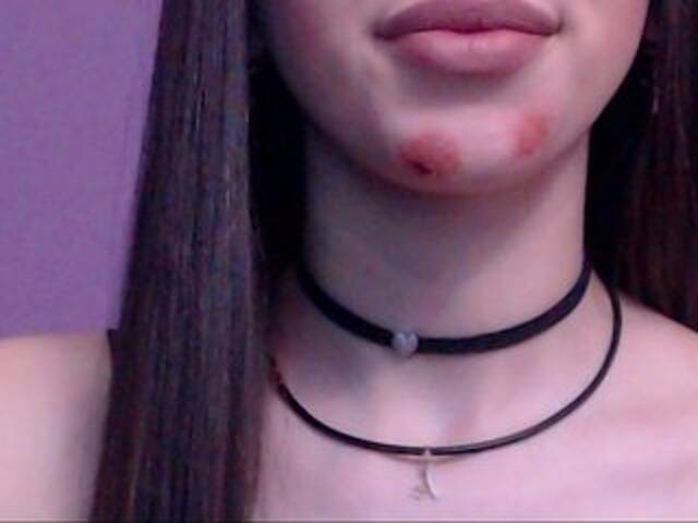 Sugárzási képernyőképek Madellyn