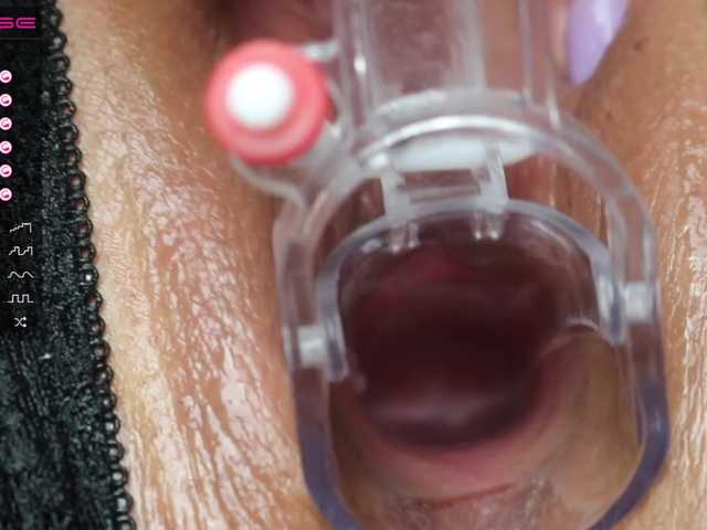 Sugárzási képernyőképek StellaFlurry